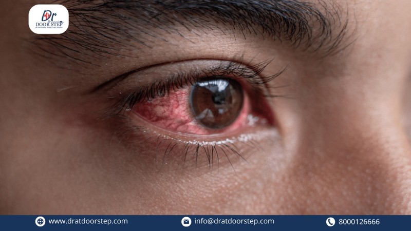 Popular Myths of Pink Eyes Busted